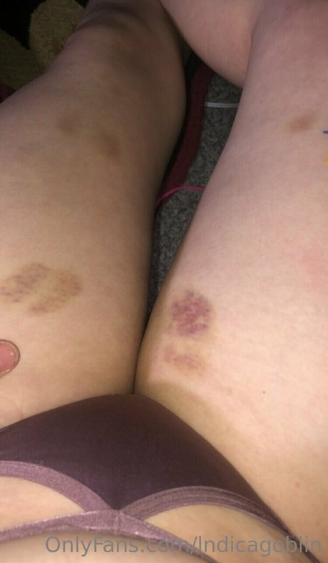 Обнаженная фотография утечки OnlyFans от Lndicagoblin
