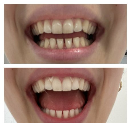 Nahá fotka uniklých OnlyFans od Zoenafree