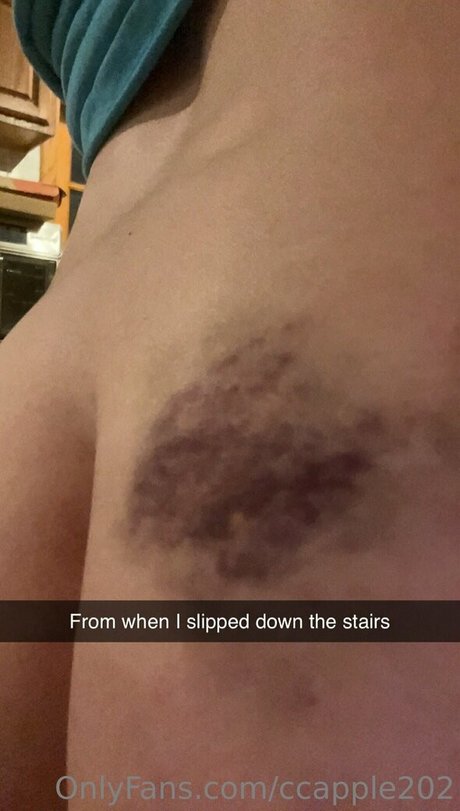 Alasti lekkinud OnlyFans-i pilt Ccapple202