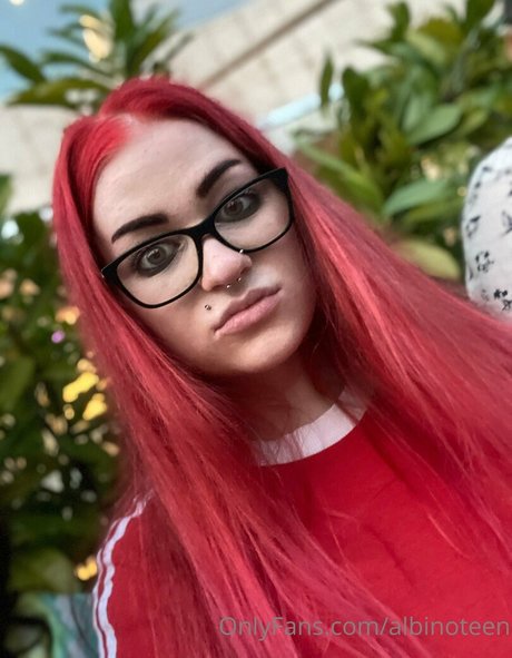 Albinoteen OnlyFansリークヌード写真